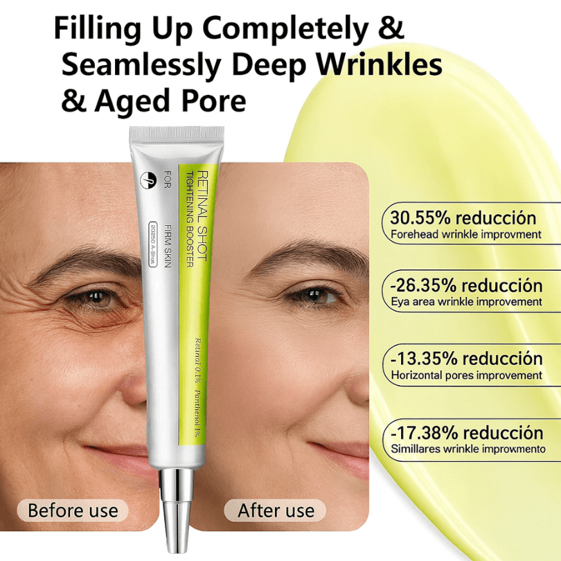 Vita A Retinal shot Tightening booster.