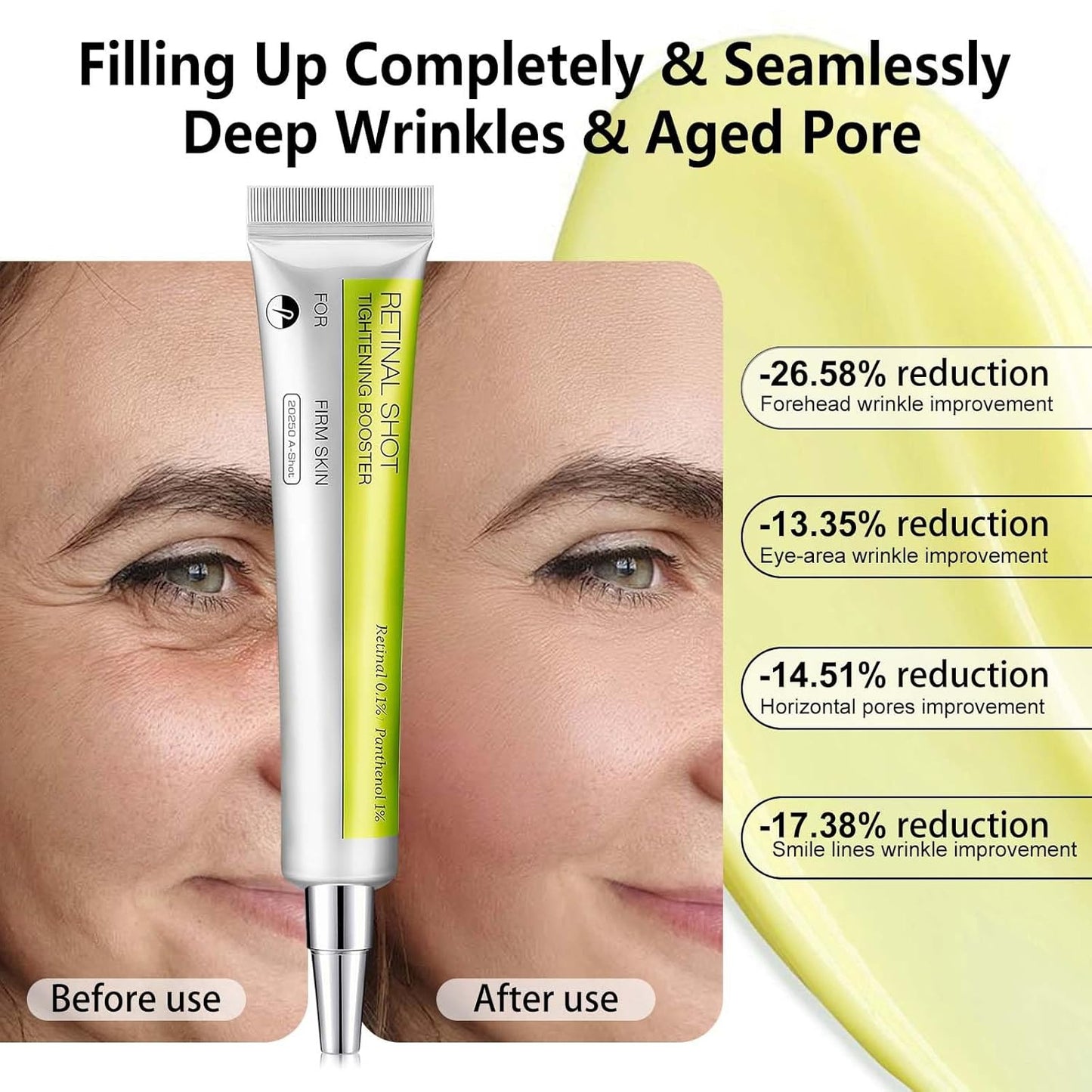 Vita A Retinal shot Tightening booster.