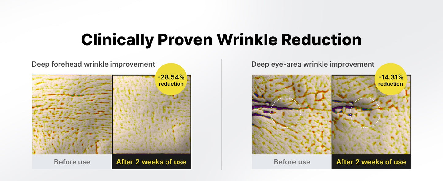 Vita A Retinal shot Tightening booster.